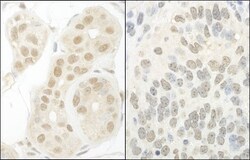 GTF2A1 Antibody, Novus Biologicals 0.1mg; Unlabeled:Antibodies, Polyclonal